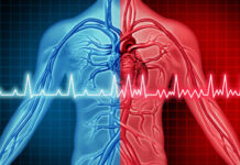 Protect Your Heart and Brain by Knowing the Signs and Symptoms of AFib
